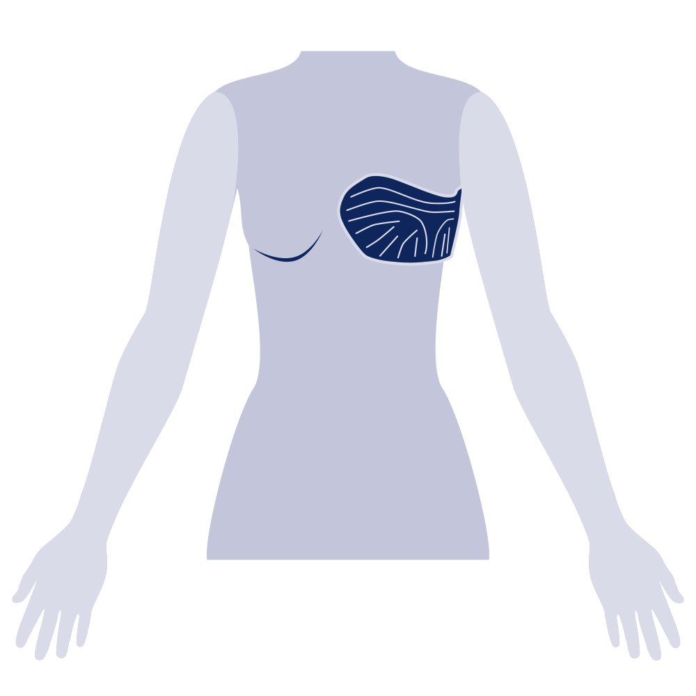 Serratus Anterior Pad